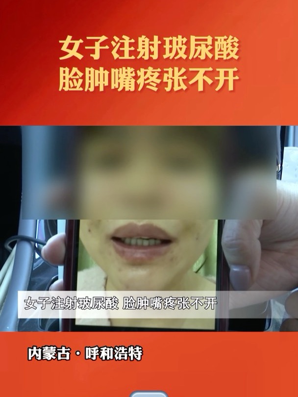 vý쿴Ůע䲣Ę[ۏ_(ki)һͺرџc(din)ᾀ